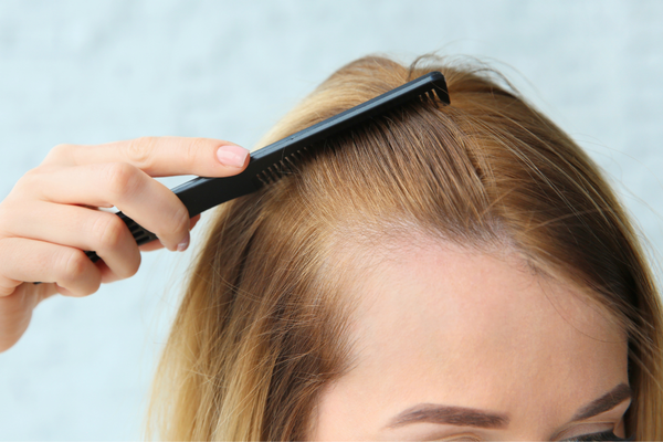 Hair Loss in Women: Why It Happens and What You Can Do