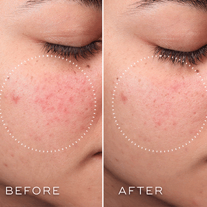 Medik8 Press & Clear