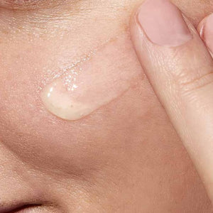 CeraVe Resurfacing Retinol Serum with Ceramides & Niacinamide for Blemish-Prone Skin 30ml