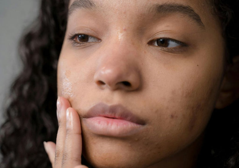 lady applying serum to her skin