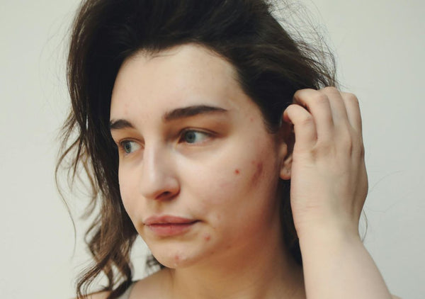 Stressed skin solutions to soothe and restore.