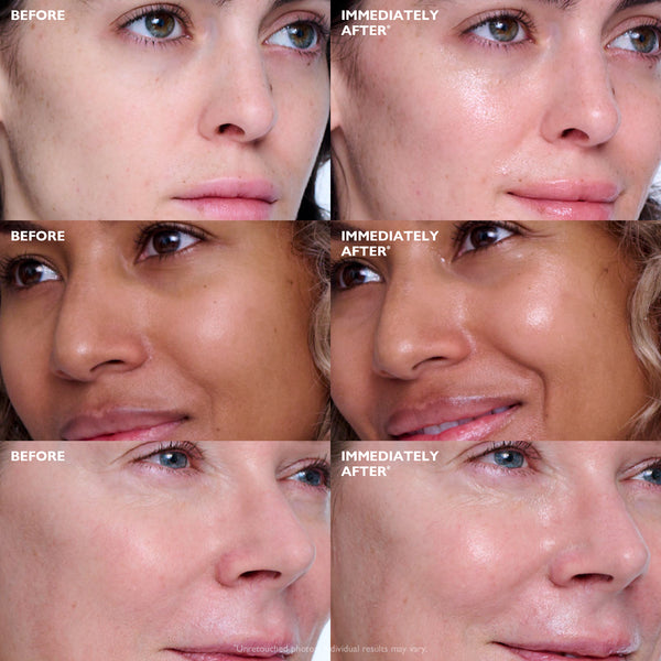 Peter Thomas Roth Collagen Skinjection™ Plumping & Firming Serum 30ml