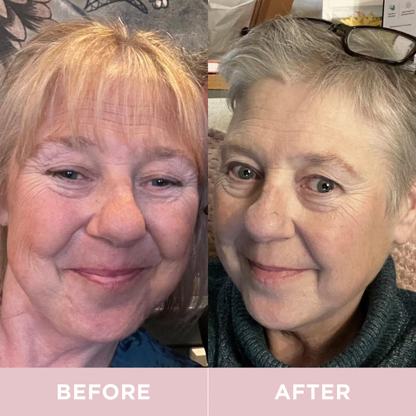 Before and after comparison of a woman's face with visible aging changes.