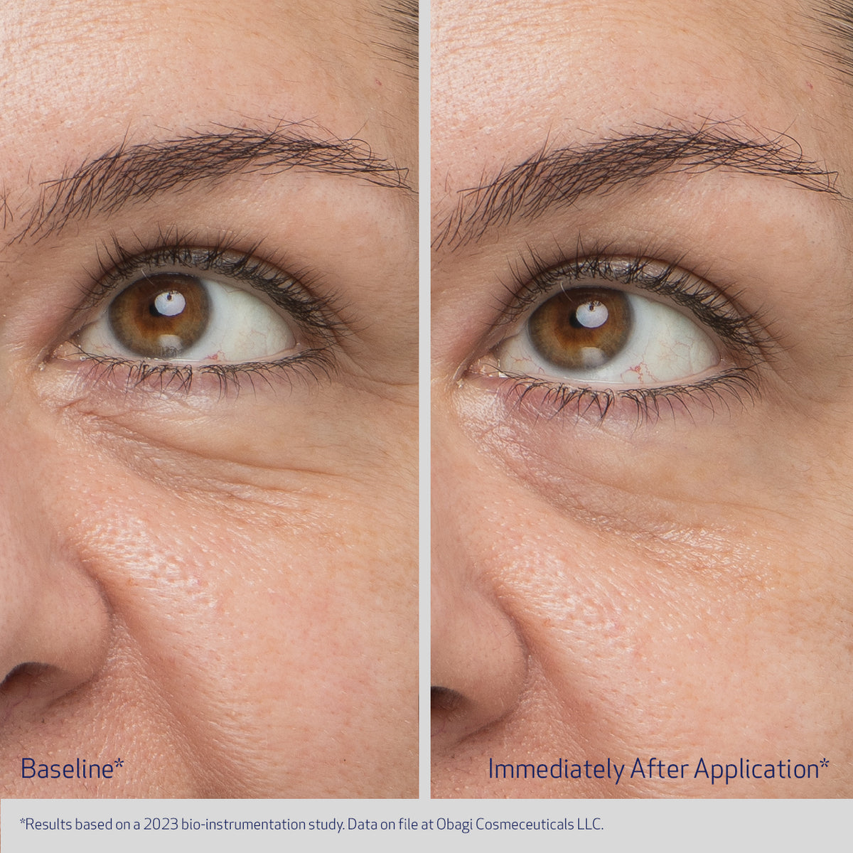 Obagi Daily Hydro-Drops Rejuvenating Eye Gel Cream