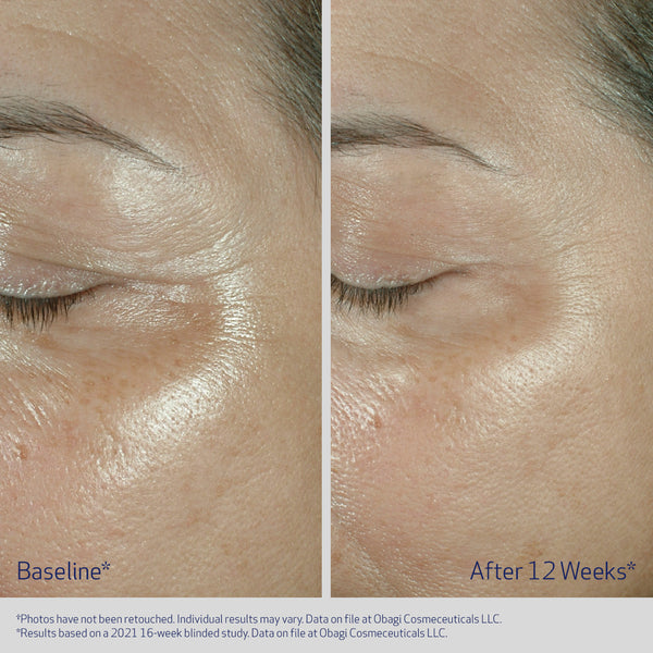Obagi Elastiderm Eye Cream