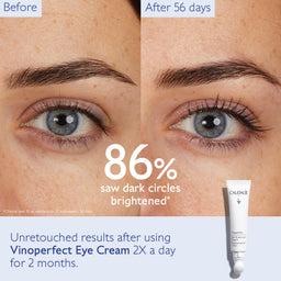 Caudalie Vinoperfect Brightening Eye Cream 15ml