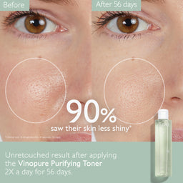 Caudalie Vinopure Purifying Toner 200ml