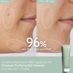 Caudalie Vinopure Purifying Gel Cleanser 150ml