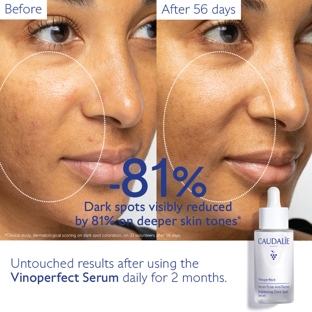 Caudalie Vinoperfect Brightening Dark Spot Serum 30ml