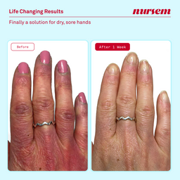 Nursem Caring Hand Cream 75ml