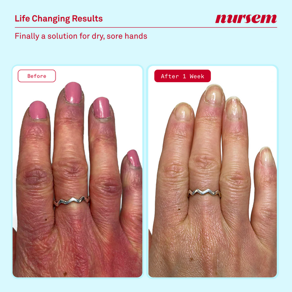 Nursem Hand Care Minis Set