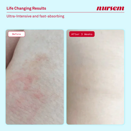 Nursem Ultra Caring Body Balm