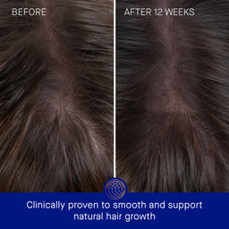 Augustinus Bader The Hair Oil