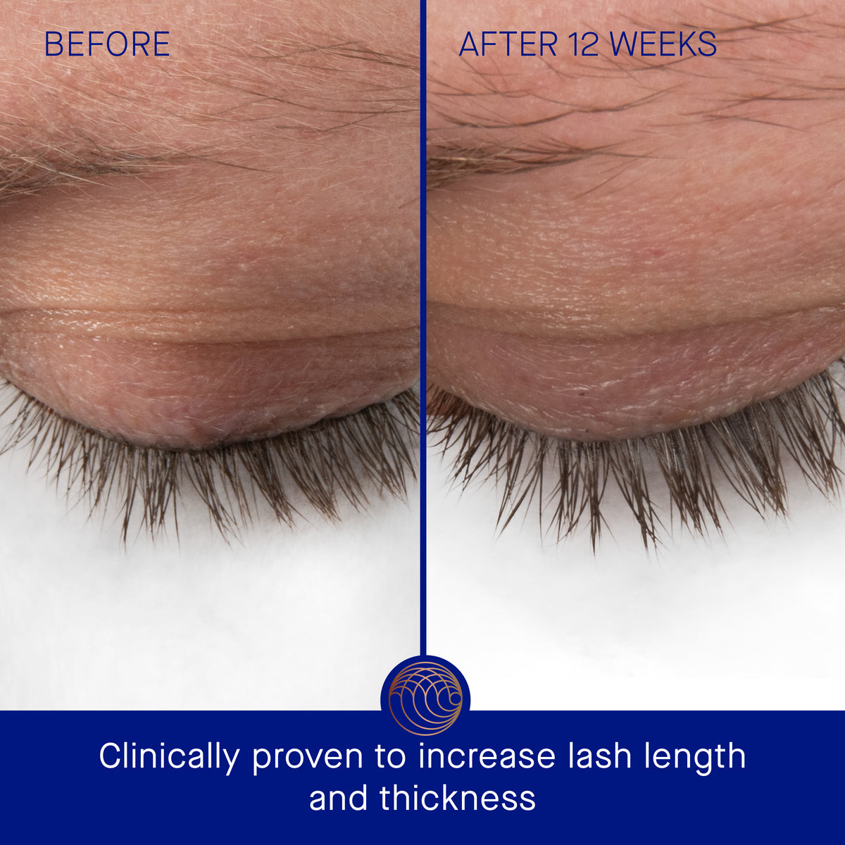 Augustinus Bader The Eyebrow & Lash Enhancing Serum 8ml - Unboxed