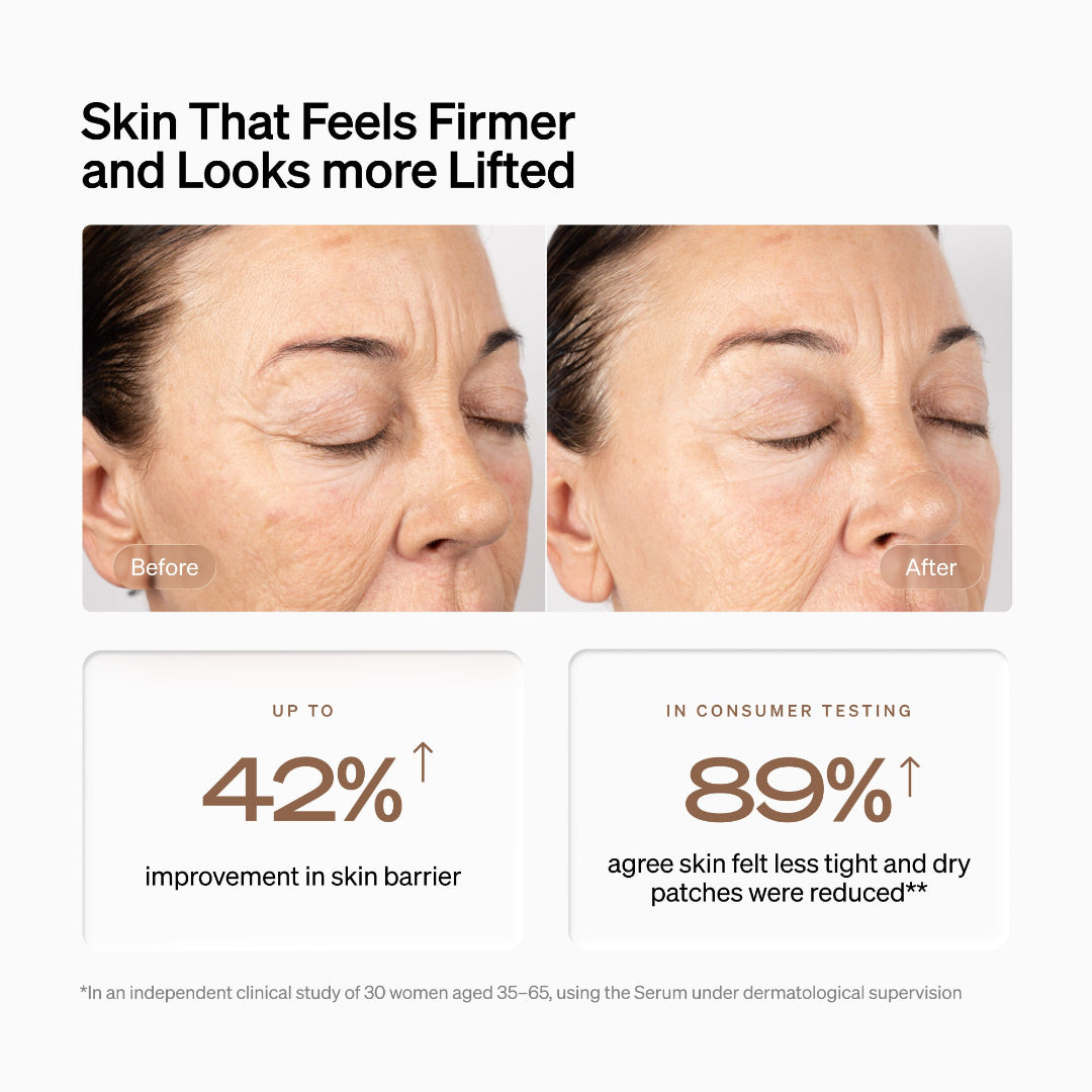 Promotional graphic for a skincare product showing before-and-after close-up photos of a woman's face, with text stating 'Skin That Feels Firmer and Looks more Lifted' and results including 'up to 42% improvement in skin barrier' and '89% agree skin felt less tight and dry patches were reduced'.