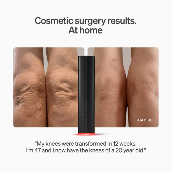 A black cylindrical cosmetic device stands in front of a before-and-after collage of knee skin, with text reading 'Cosmetic surgery results. At home' and a testimonial quote below.