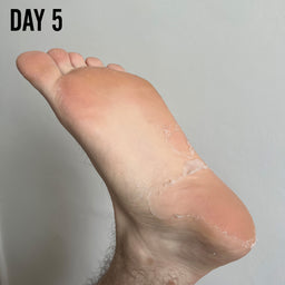 BARBER PRO Foot Peel 30ml
