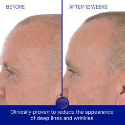 Augustinus Bader The Retinol Serum 30ml