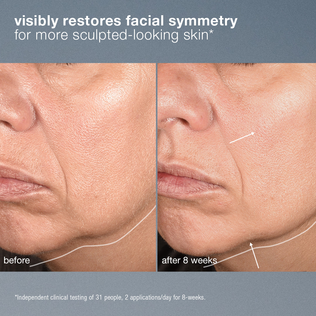 Before and after comparison of facial skin treatment showing restored symmetry.