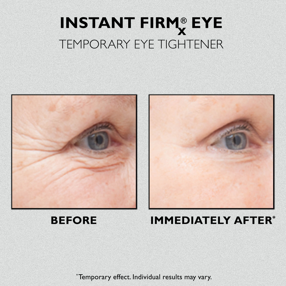 Peter Thomas Roth Instant FIRMx Eye Temporary Eye Tightener 15ml