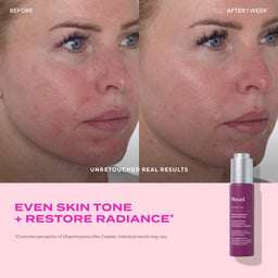 Murad Cellular Hydration Repair Oil Drops