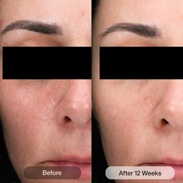 Revision Skincare D·E·J Daily Boosting Serum 60ml