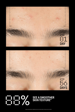 Before-and-after skincare comparison showing close-up eyebrow and skin texture on a black background, with text reading 'AFTER 01 DAY' and 'AFTER 56 DAYS' and '88% SEE A SMOOTHER SKIN TEXTURE'.