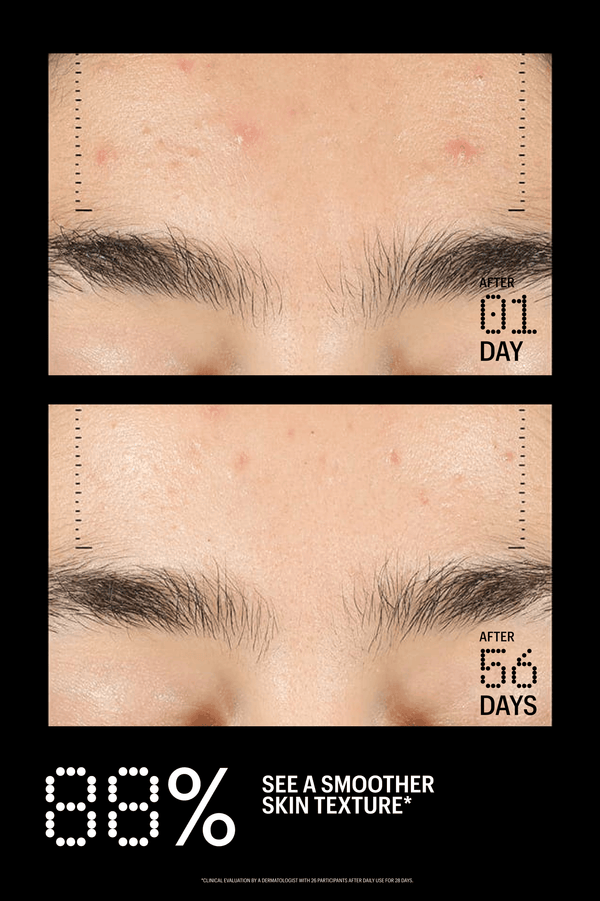 Before-and-after skincare comparison showing close-up eyebrow and skin texture on a black background, with text reading 'AFTER 01 DAY' and 'AFTER 56 DAYS' and '88% SEE A SMOOTHER SKIN TEXTURE'.