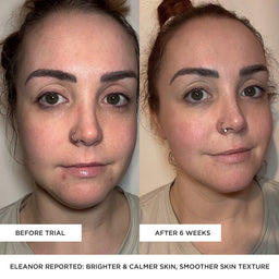 BEAUTYPRO LED Wand 5 In 1 Anti-Ageing Device