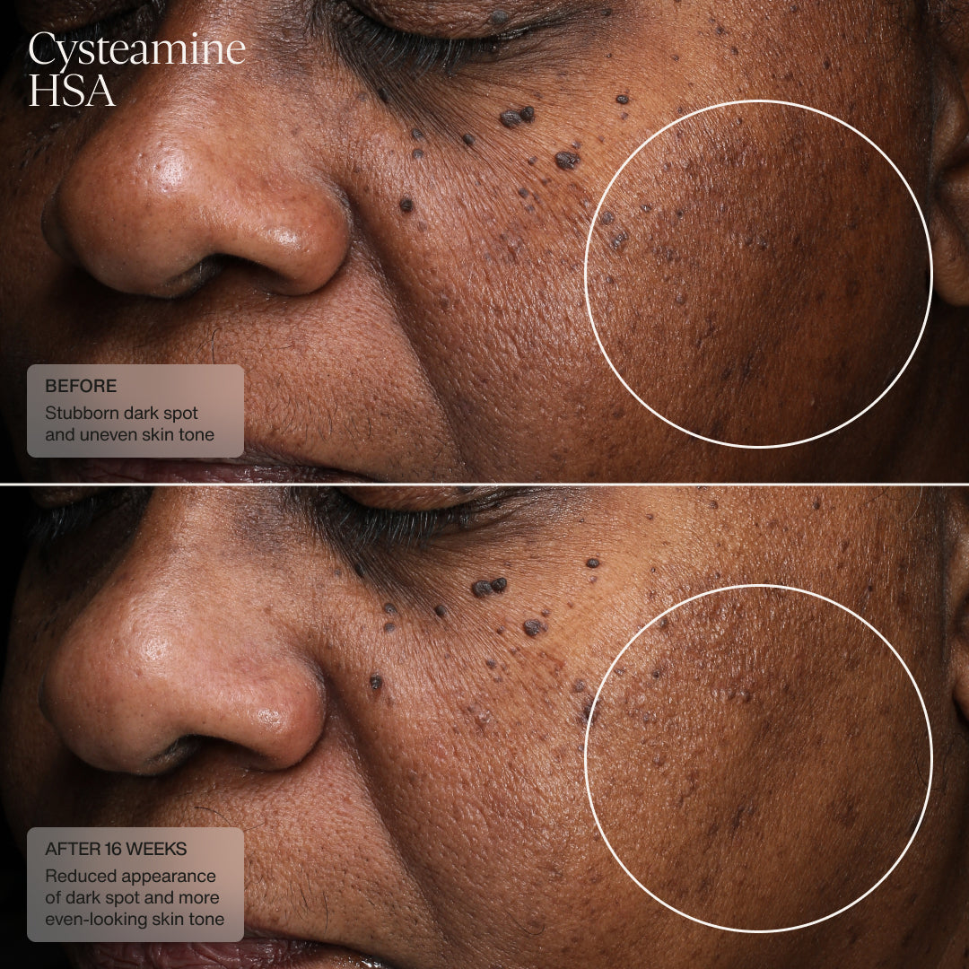 Senté Dermal Repair Kit