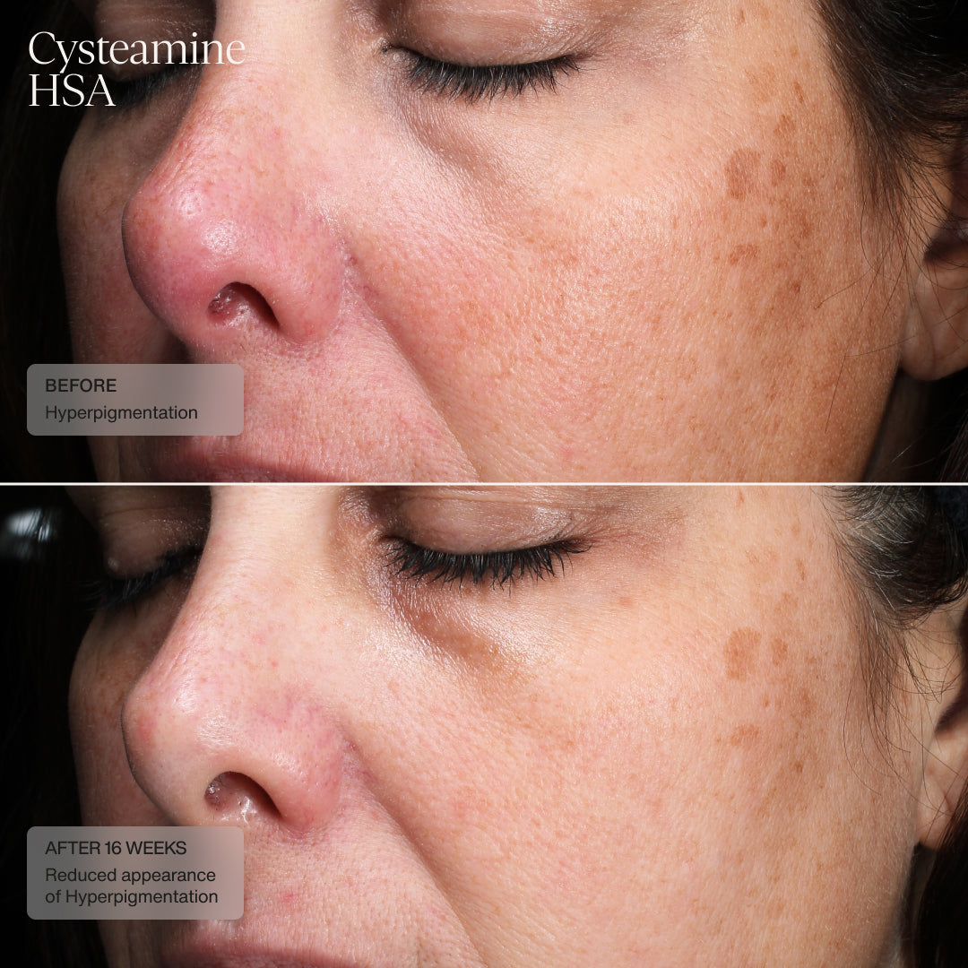 Senté Dermal Repair Kit
