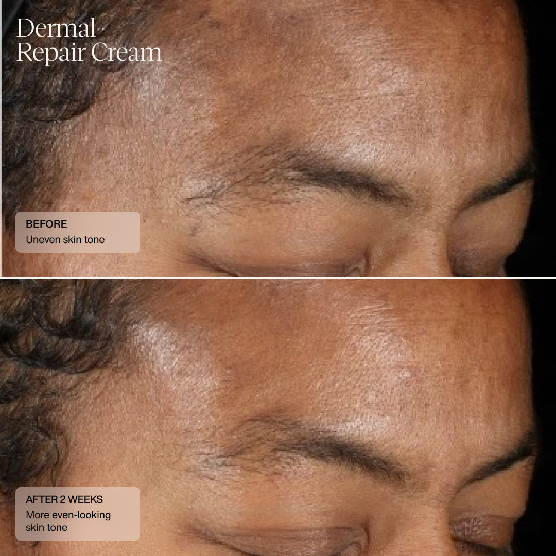 Senté Dermal Repair Kit