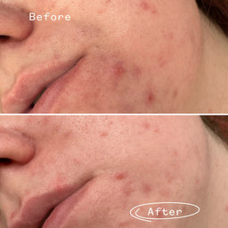 Pai Skincare Phaze Rebalancing PHA Cleanser 28ml