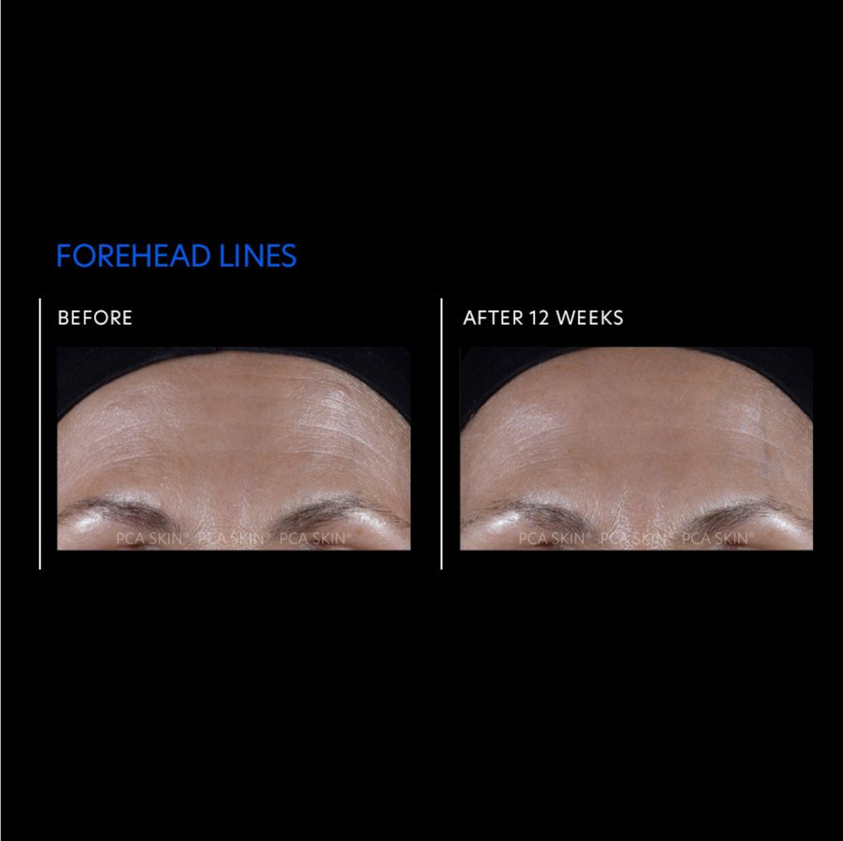 before and after