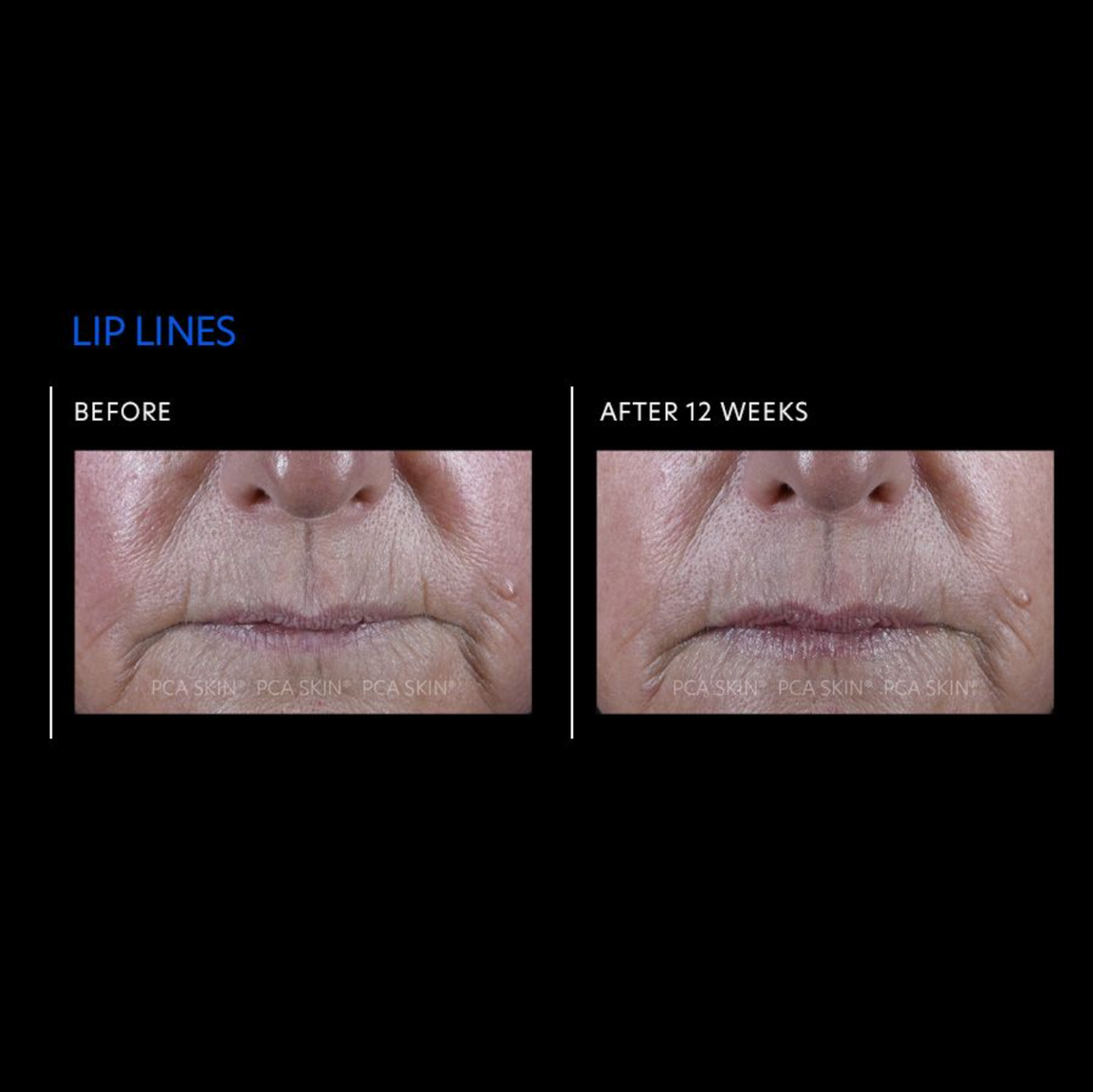 before and after
