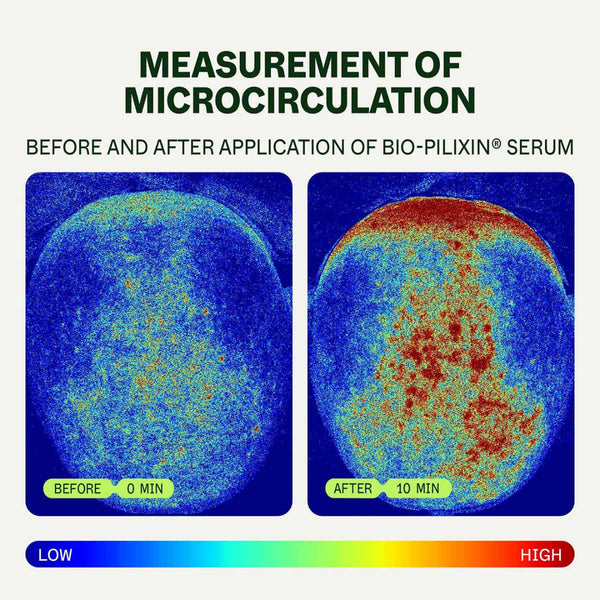 Before and after measurement of microcirculation using Bio-Pilixin Serum on a circular surface.