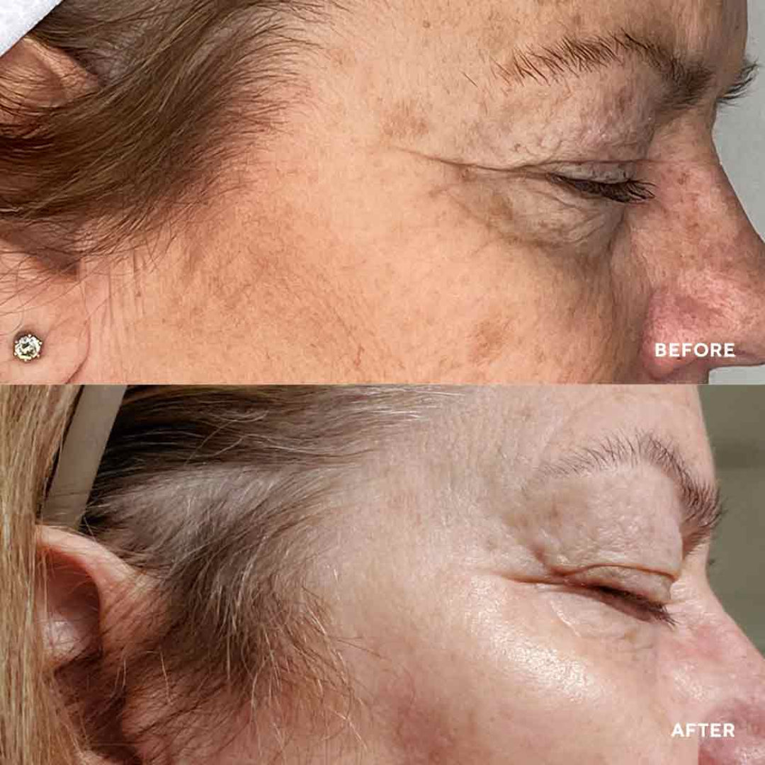 HydroPeptide Vital Eyes Instant Awakening Serum