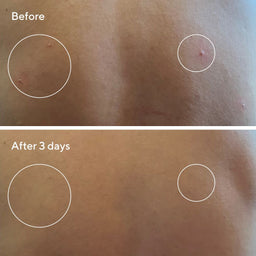 Murad Retexturizing Body Pads