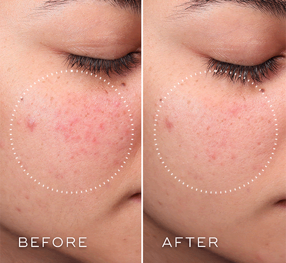 Medik8 Press & Clear