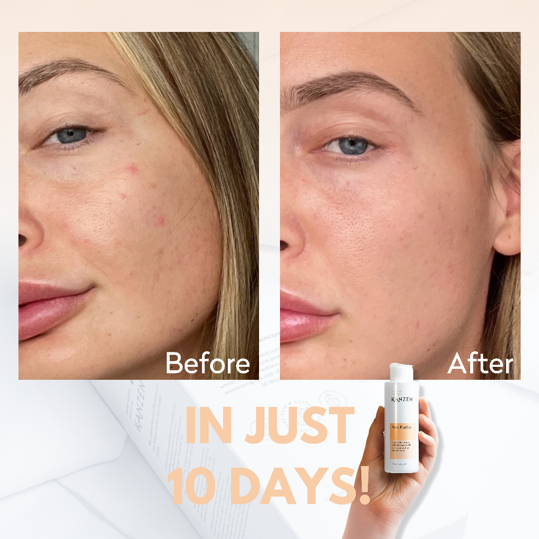 Kanzen Derma Pore Purifier