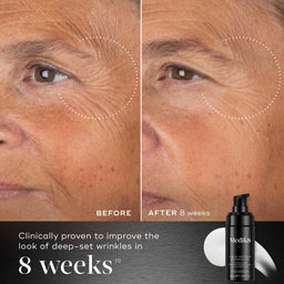 Before and after comparison of a person's face with deep-set wrinkles, showing improvement after 8 weeks, with Medik8 product displayed.
