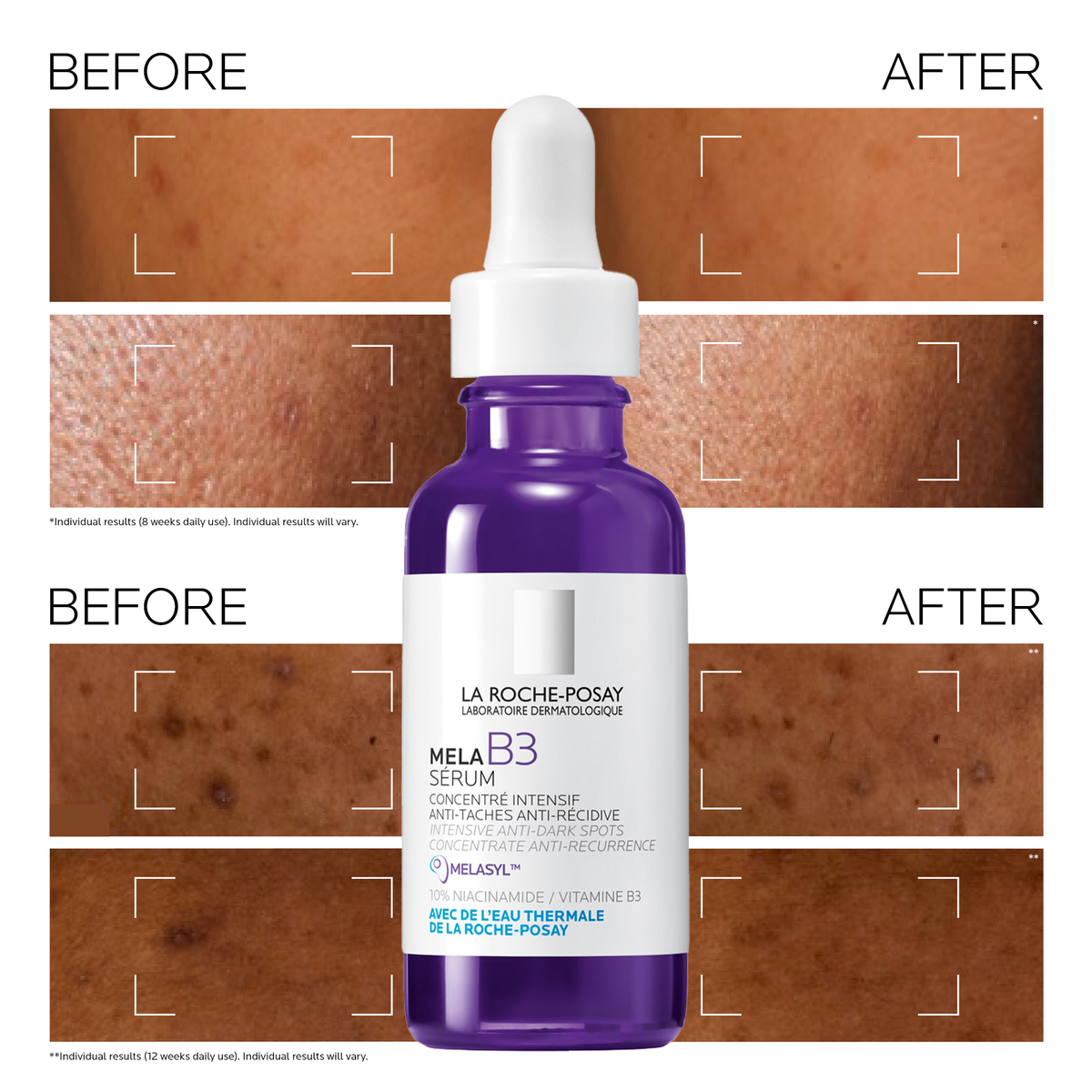 La Roche-Posay Mela B3 Serum Intense Anti-Dark Spot Serum For Hyperpigmentation 50ml