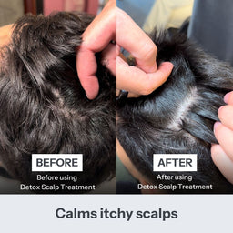 Side-by-side before and after comparison of a dog's scalp treatment, showing drier, less itchy dark fur and clearer scalp lines after using a detox scalp treatment. Text at the bottom reads 'Calms itchy scalps'.