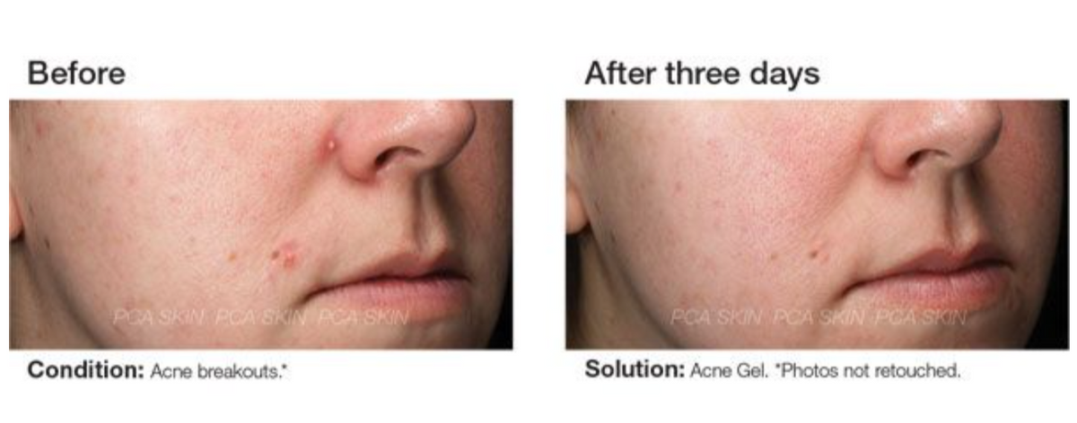 before and after
