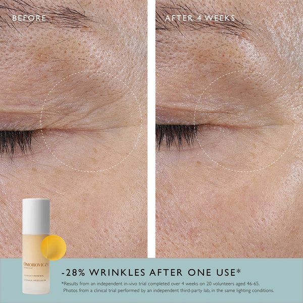 Omorovicza Midnight Renewal Serum 30ml