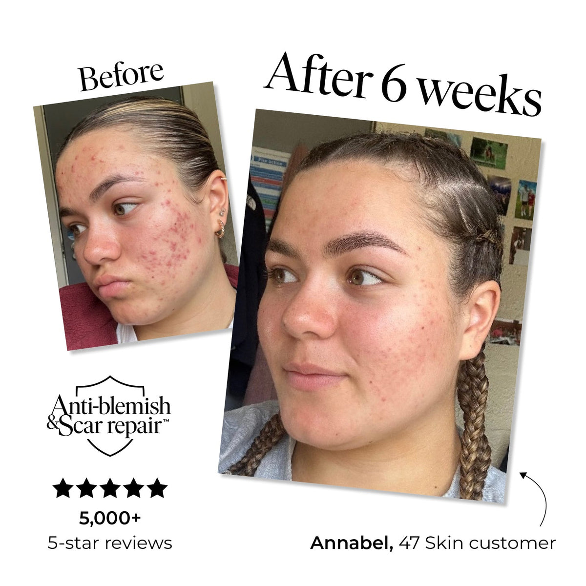 47 Skin Anti-Blemish and Scar Repair Serum 30ml