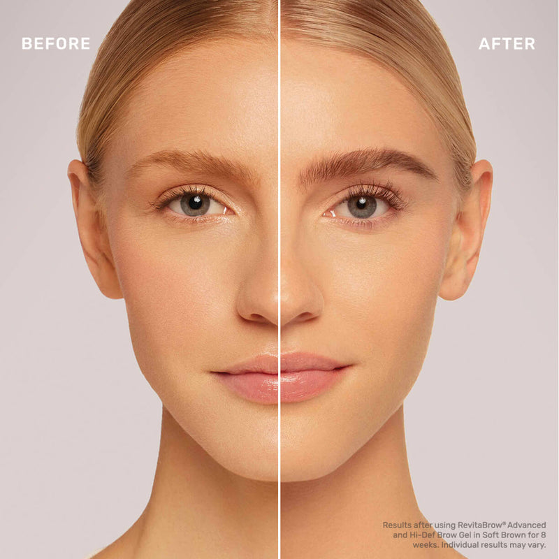 before and after