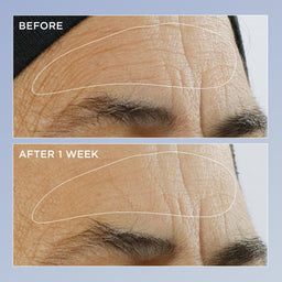 Perricone MD High Potency Triple Retinol Renewal Serum 59ml