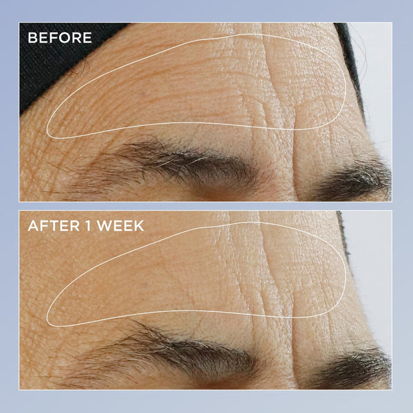 Perricone MD High Potency Triple Retinol Renewal Serum 59ml