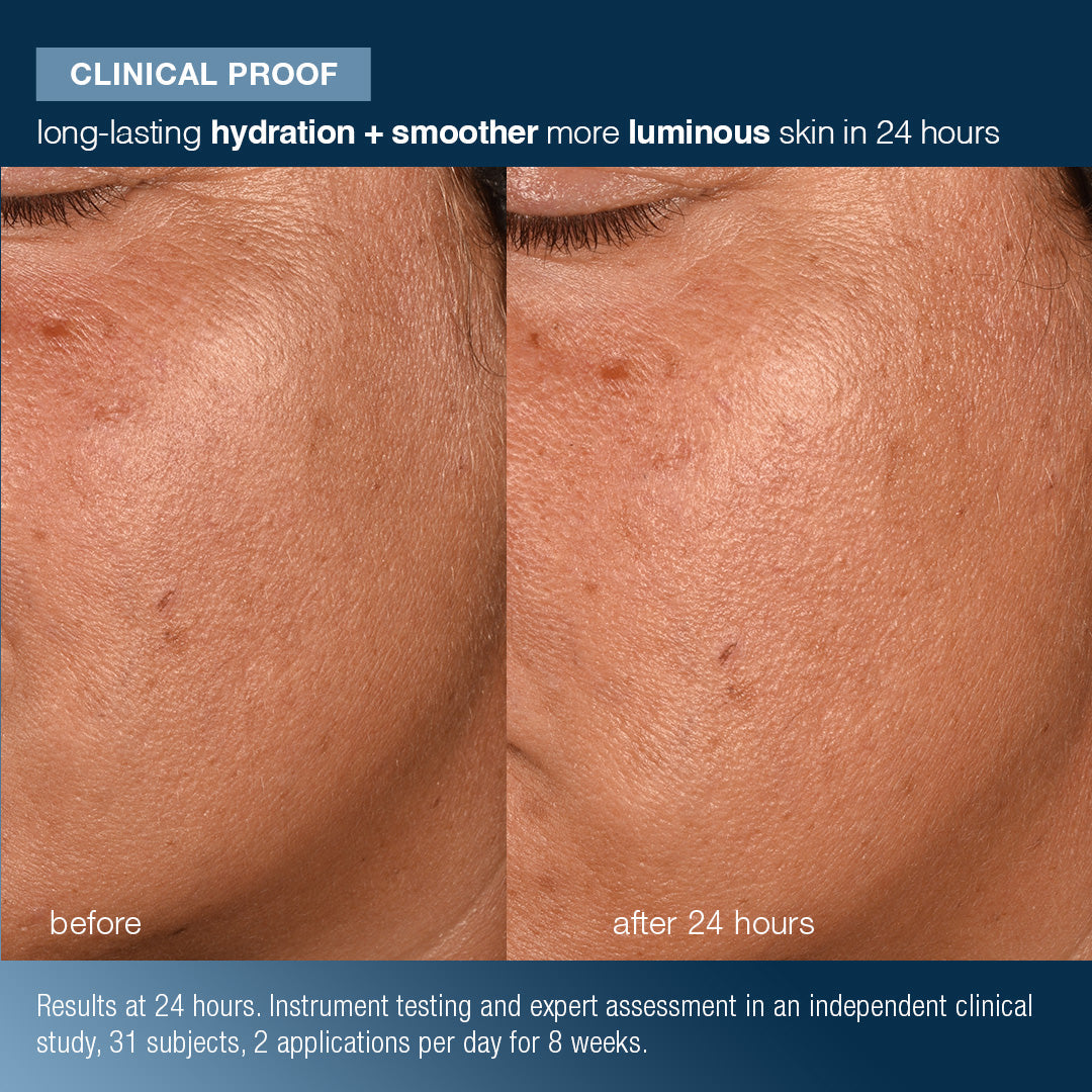 Before and after comparison of skin hydration and smoothness with text indicating results in 24 hours.